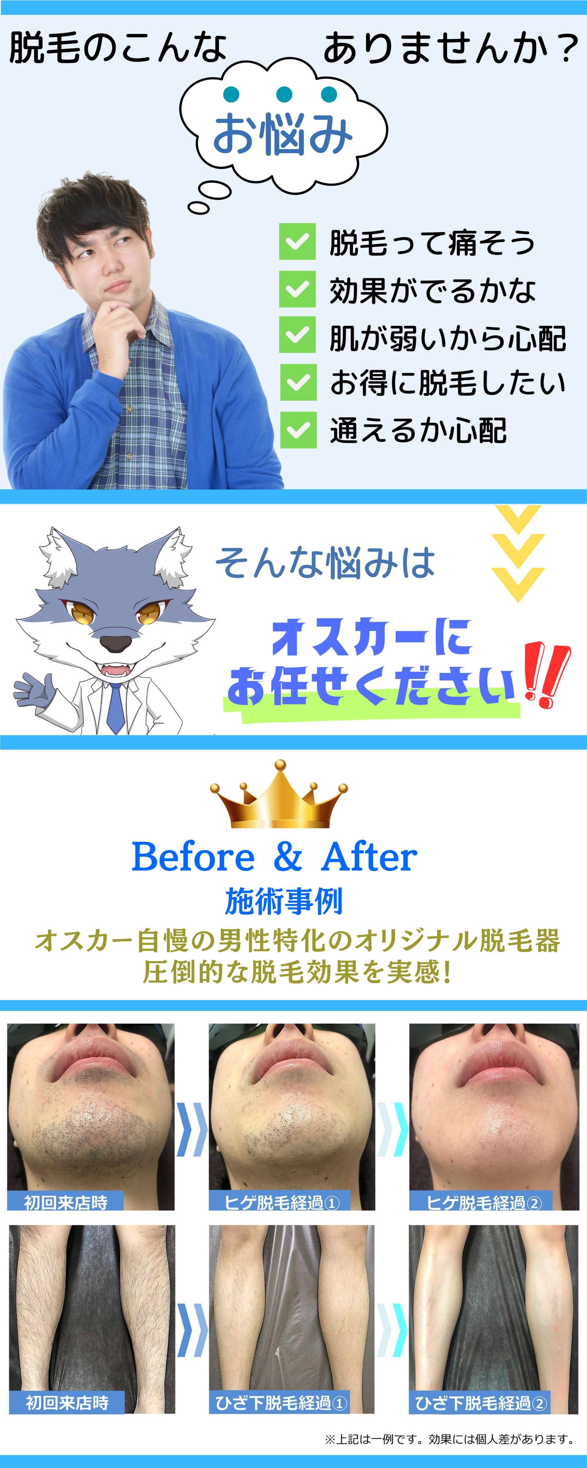 ヒゲ脱毛お試しプラン